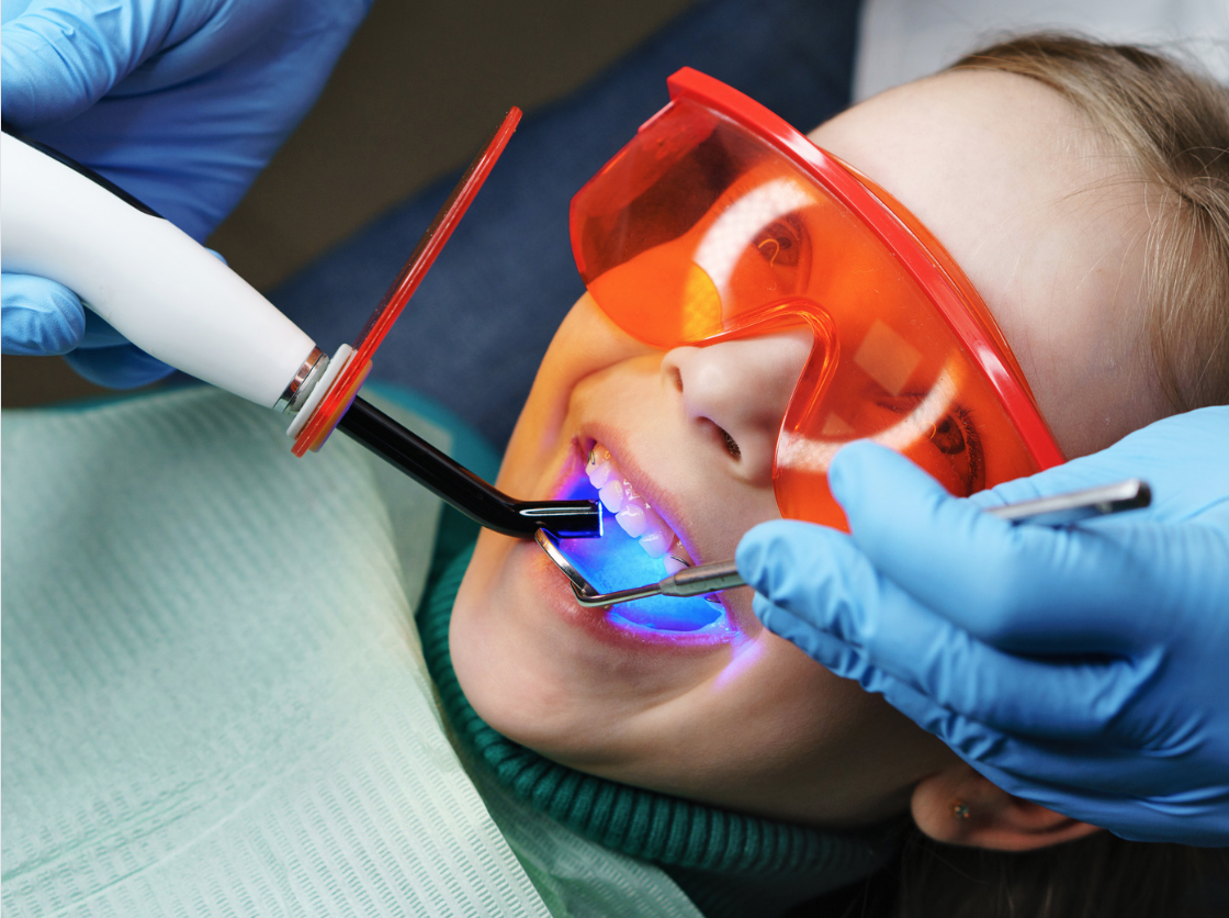 A young patient getting dental sealants in Midlothian